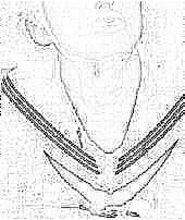 (image)